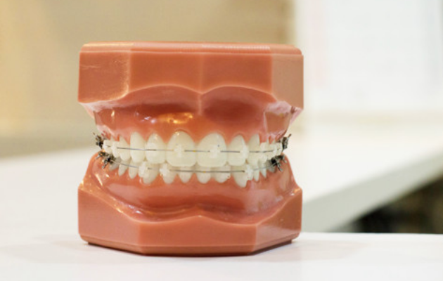 矯正歯科の画像